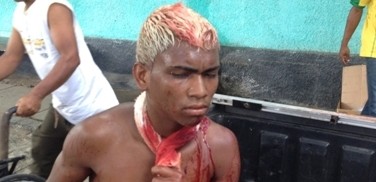 Fernandinho que reside no Bairro ACM, foi conduzido pata o HBLEM