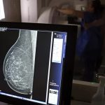 BRASIL DEVE FECHAR 2025 COM 73,6 MIL NOVOS CASOS DE CÂNCER DE MAMA