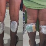 SCANNER FLAGA CINCO MULHERES COM DROGAS NAS PANTURRILHAS EM PRESÍDIO DE SALVADOR