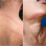 ILHÉUS: PROFESSOR É DENUNCIADO POR AGREDIR GAROTO DE 8 ANOS COM CIPÓ DE GOIABEIRA