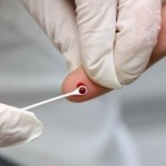 SUBSECRETÁRIO DE SAÚDE RELATA QUE TRÊS  PESSOAS TIVERAM TESTE POSITIVO  PARA HIV NO CARNAVAL